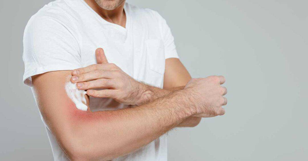 A person applies a white cream to their elbow, irritated by eczema. They are wearing a white t-shirt against a plain gray background.